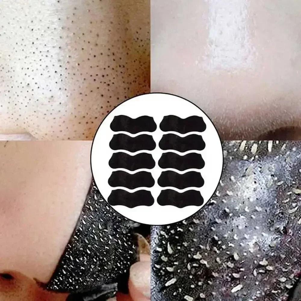 20pcs Nose Strips for Blackheads