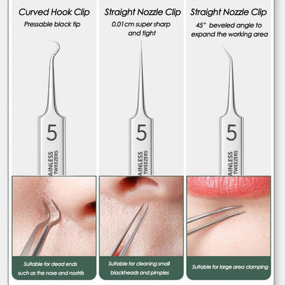Blackhead and Acne Removal Needles Kit