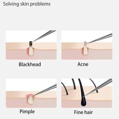 Blackhead and Acne Removal Needles Kit